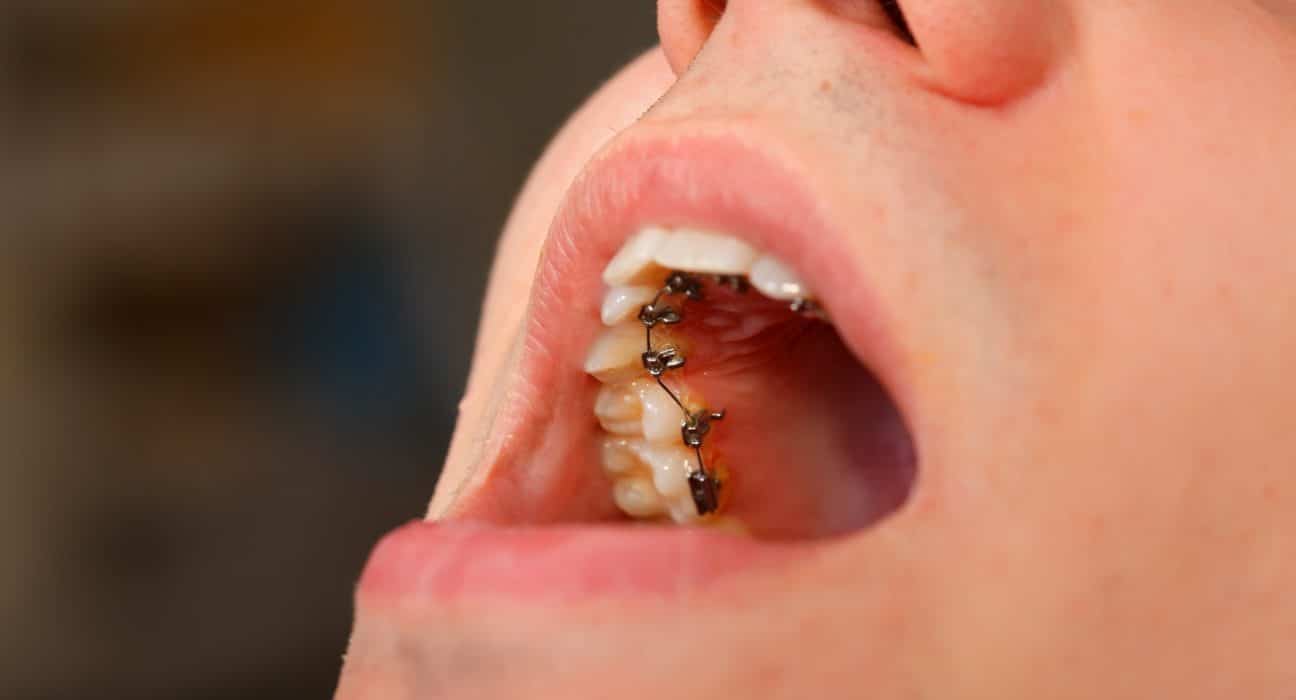 DfHSeUh1VY1hv1UNYll3